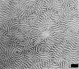Group of myxobacteria; black bar is about 200 microns.